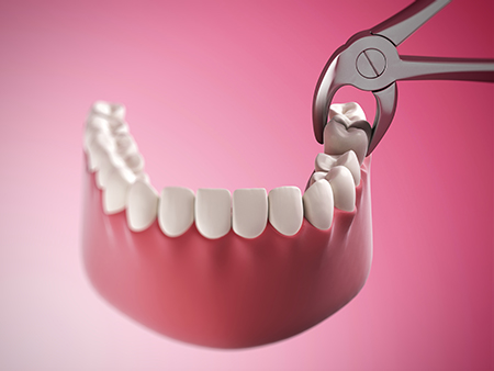 The image shows a close-up view of a dental device holding a set of teeth with visible gaps, being prepared for a dental procedure with a pair of scissors nearby, against a red background.