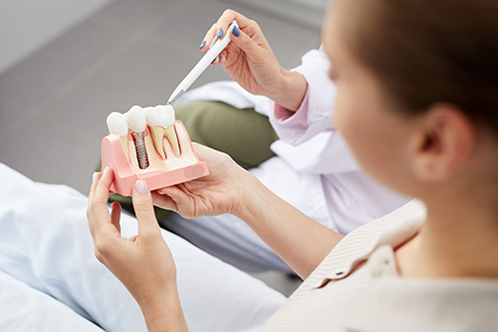 A woman holding a dental model with a toothpick while standing in front of a dental professional.