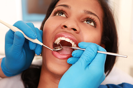 A woman receiving dental care, with her mouth open and a dental professional attending to her teeth.
